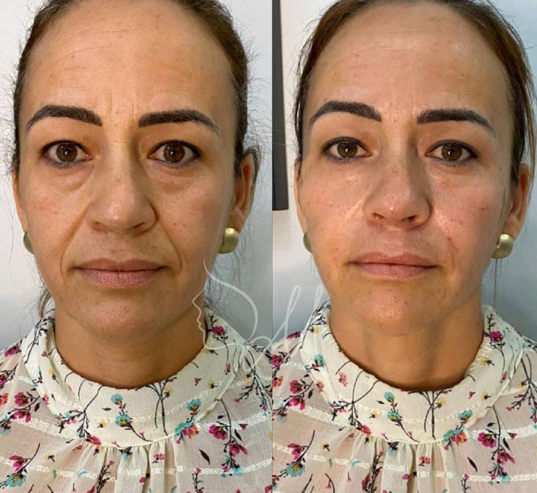 Preenchimento de bigode chinês